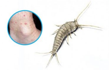 Silverfish Pest Control Melbourne | Silverfish Removal & Treatment